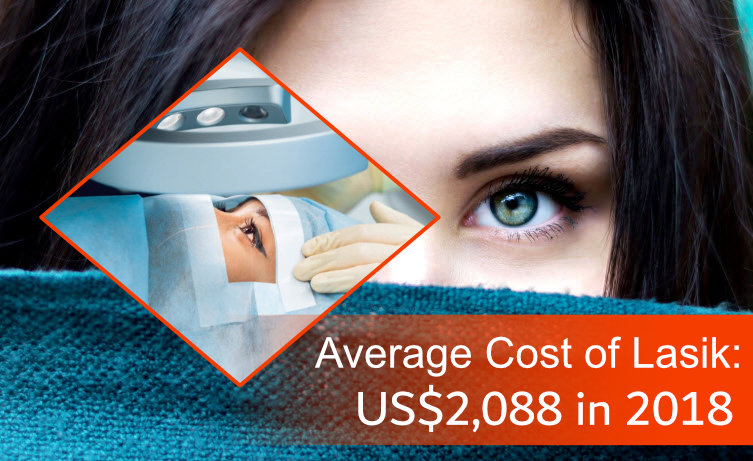 Average Cost of Lasik Eye Surgery in 2018